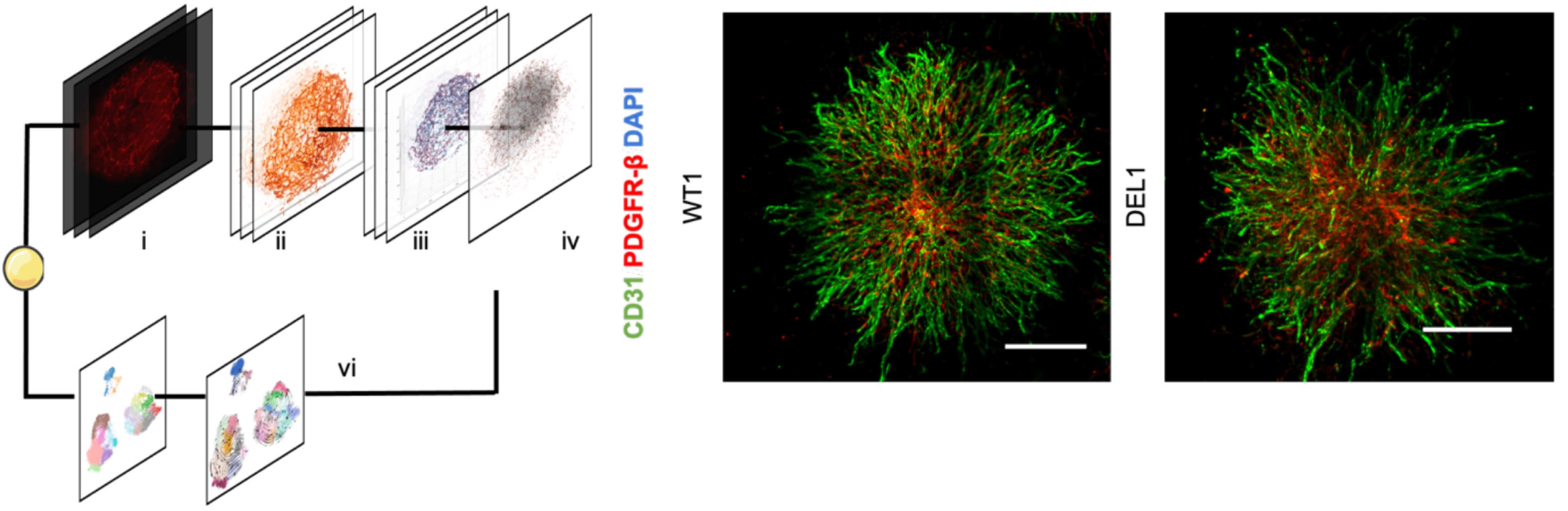 Publication_Pending_VesselOrganoid.jpg