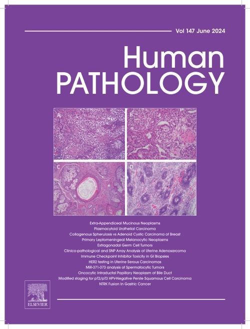 Research Highlighted on Cover of Human Pathology, June 2024