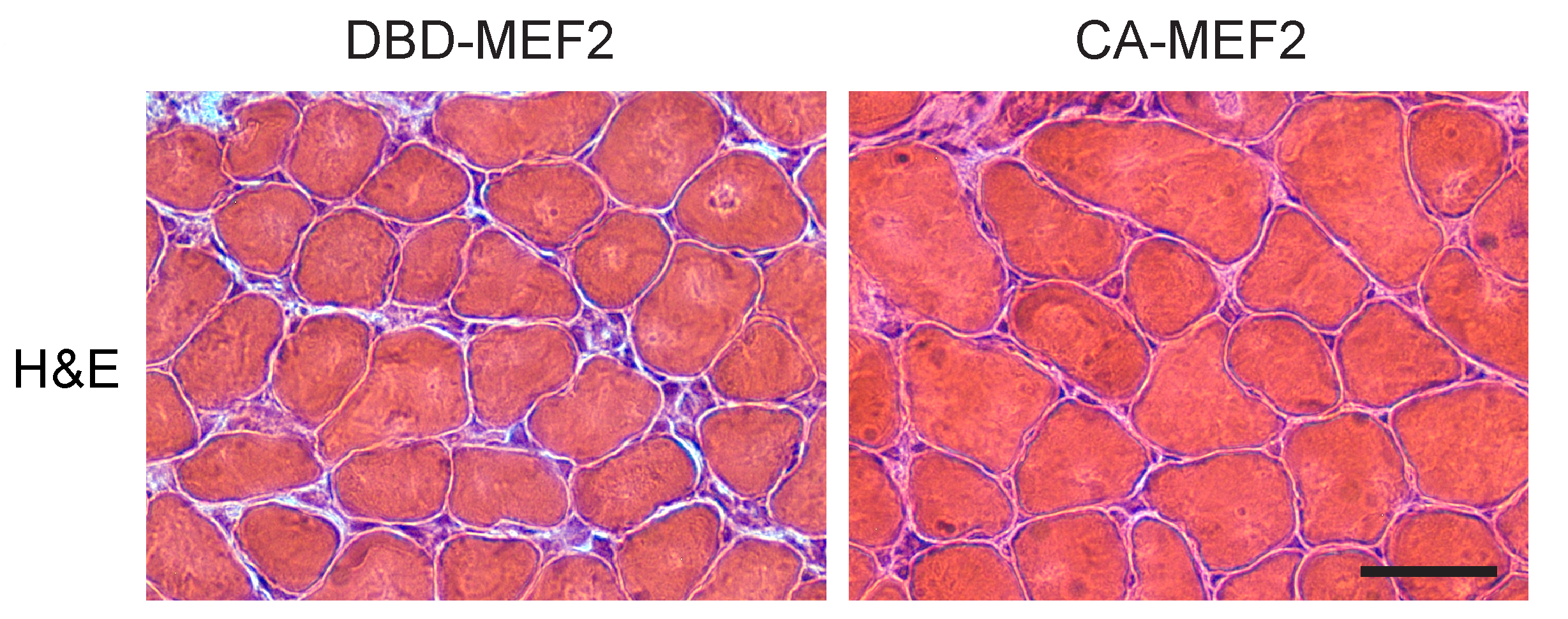 AR113Q limb muscle was examined 7 days after transfection with constitutively actively MEF2 (on right) or inactive MEF2 (on left). Expression of CA-MEF2 caused a significant rescue of muscle fiber size.